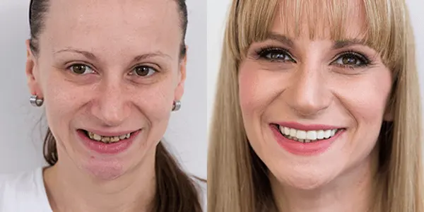 Makeover 2015 | Štimac Centar dentalne medicine Zagreb | Makeover 2015 | Stomatološka poliklinika Zagreb | Štimac centar dentalne medicine