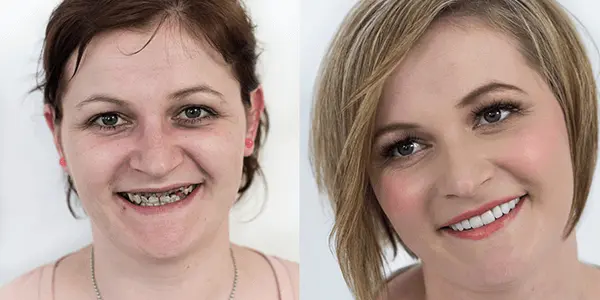 Makeover 2015 | Štimac Centar dentalne medicine Zagreb | Makeover 2015 | Stomatološka poliklinika Zagreb | Štimac centar dentalne medicine