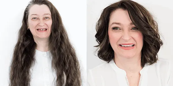 Makeover 2015 | Štimac Centar dentalne medicine Zagreb | Makeover 2015 | Stomatološka poliklinika Zagreb | Štimac centar dentalne medicine