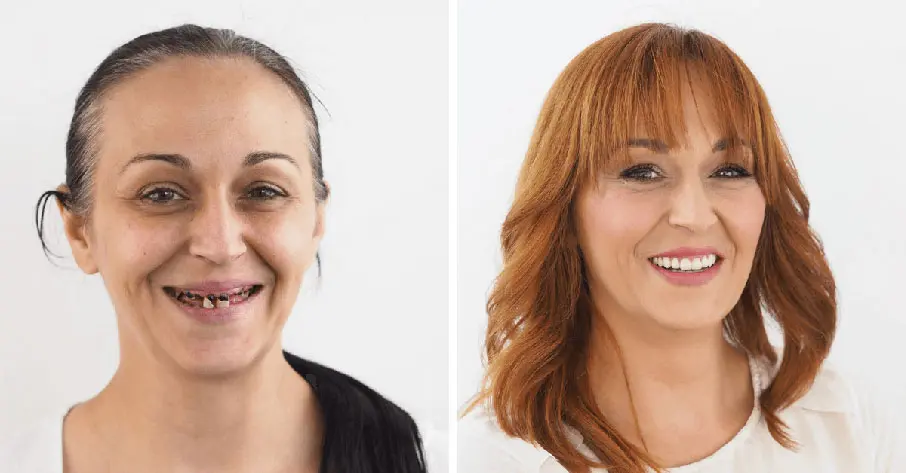 Makeover 2018 | Štimac Centar dentalne medicine Zagreb | Makeover 2018 | Stomatološka poliklinika Zagreb | Štimac centar dentalne medicine