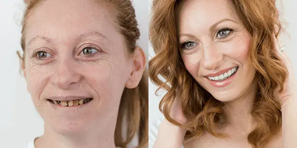 Makeover 2016 | Stomatološka poliklinika Štimac, Zagreb | Makeover 2016 | Stomatološka poliklinika Zagreb | Štimac centar dentalne medicine