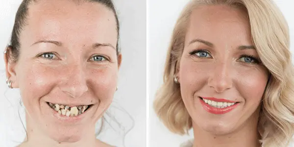 Makeover 2016 | Stomatološka poliklinika Štimac, Zagreb | Makeover 2016 | Stomatološka poliklinika Zagreb | Štimac centar dentalne medicine