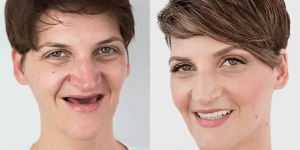 Makeover 2016 | Stomatološka poliklinika Štimac, Zagreb | Makeover 2016 | Stomatološka poliklinika Zagreb | Štimac centar dentalne medicine
