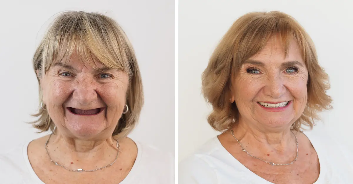 Makeover 2018 | Štimac Centar dentalne medicine Zagreb | Makeover 2018 | Stomatološka poliklinika Zagreb | Štimac centar dentalne medicine