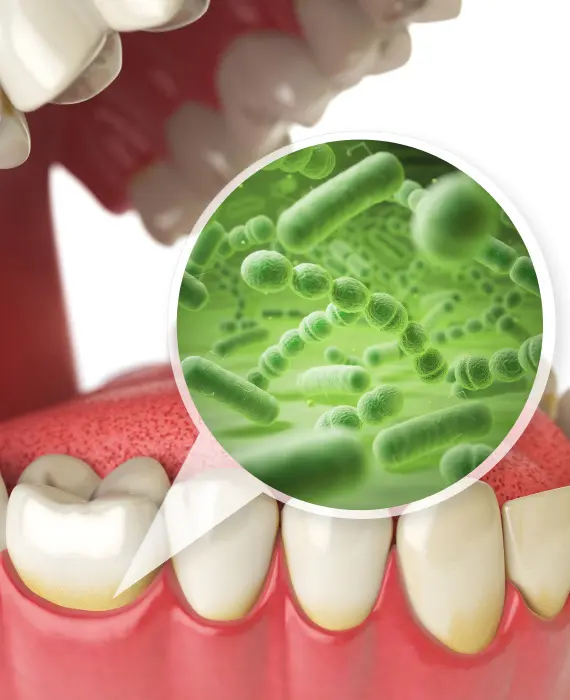 Čišćenje zubnog kamenca | Stomatološka poliklinika Štimac | Zagreb | Čišćenje zubnog kamenca | Stomatološka poliklinika Zagreb | Štimac centar dentalne medicine