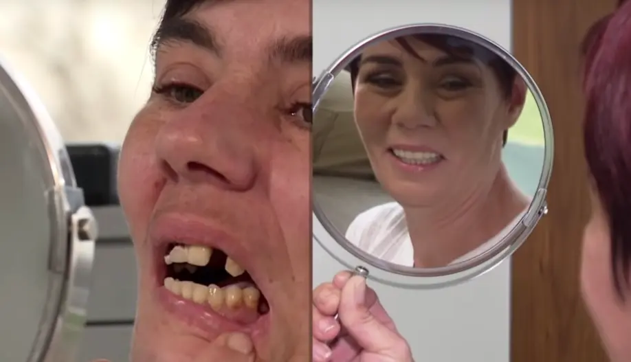 Makeover 2018 | Štimac Centar dentalne medicine Zagreb | Makeover 2018 | Stomatološka poliklinika Zagreb | Štimac centar dentalne medicine