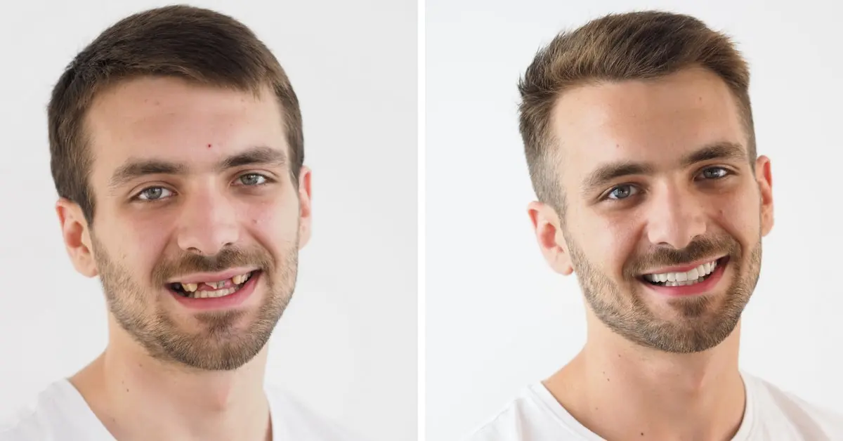 Makeover 2018 | Štimac Centar dentalne medicine Zagreb | Makeover 2018 | Stomatološka poliklinika Zagreb | Štimac centar dentalne medicine