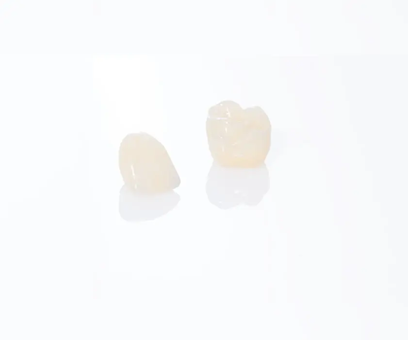 Zubne krunice u Hrvatskoj | Stomatološka poliklinika Zagreb | Štimac centar dentalne medicine