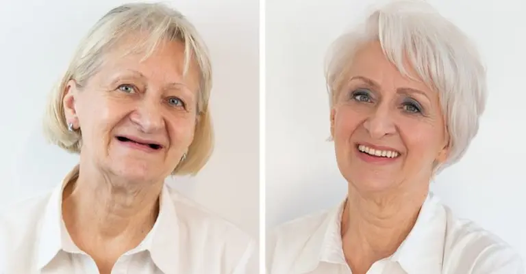 Makeover | Ivana | Stomatološka poliklinika Štimac | Zagreb | Makeover 2019 | Stomatološka poliklinika Zagreb | Štimac centar dentalne medicine