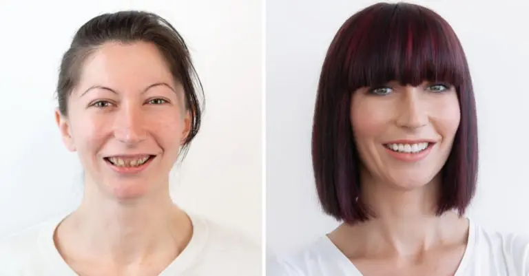 Makeover | Ivana | Stomatološka poliklinika Štimac | Zagreb | Makeover 2019 | Stomatološka poliklinika Zagreb | Štimac centar dentalne medicine