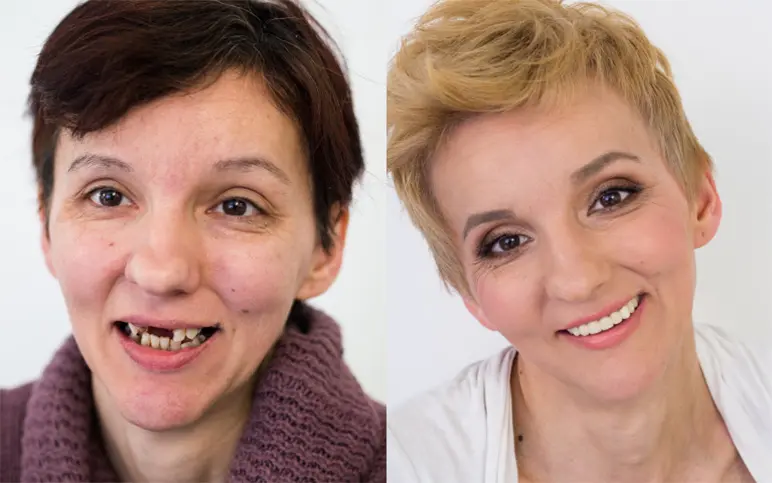 Makeover 2014 | Stomatološka poliklinika Štimac | Zagreb | Makeover 2014 | Stomatološka poliklinika Zagreb | Štimac centar dentalne medicine